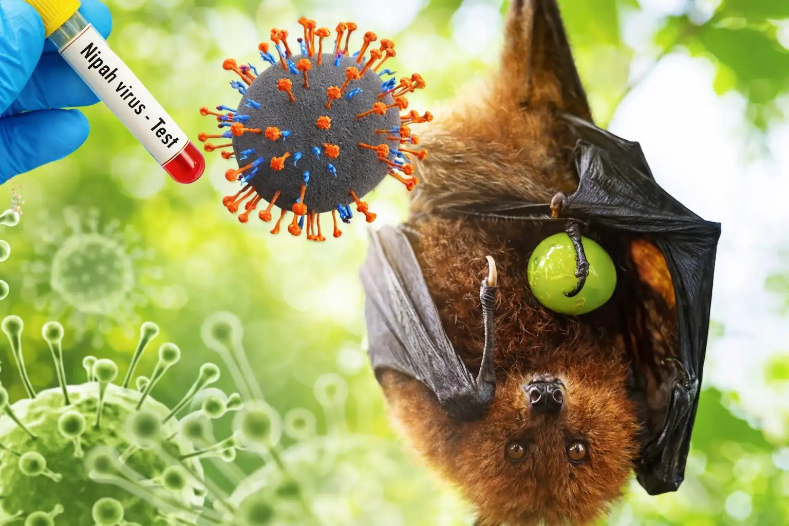 Virus Nipah Ramai, Dokter: Jangan Panik Dulu